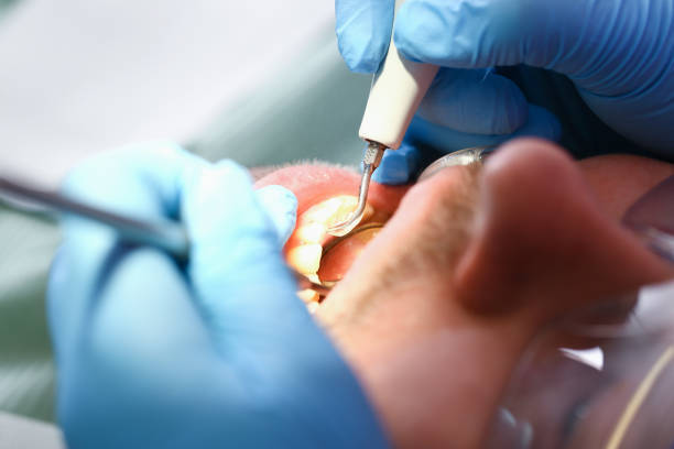 Best Emergency Dentist for Knocked-Out Tooth in Corsicana, TX