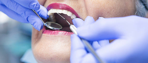 Best Emergency Dental Extractions in Corsicana, TX